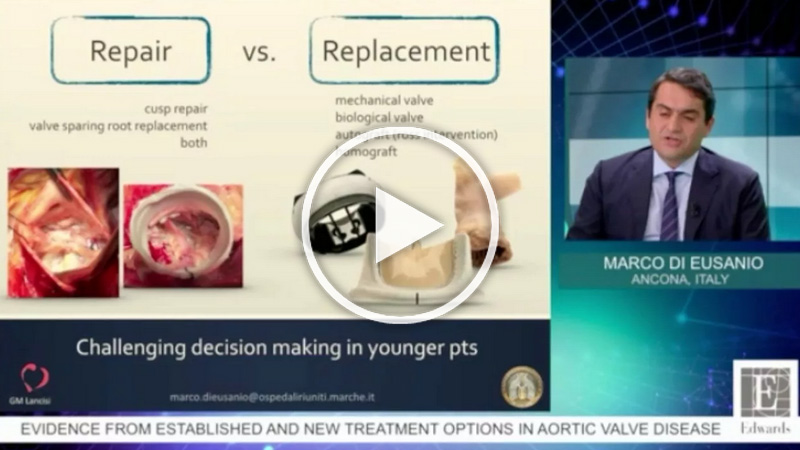 https://www.minicardiacsurgery-univpm-research.com/wp-content/uploads/2021/03/5-Challanging-decision-making-in-patients.jpg