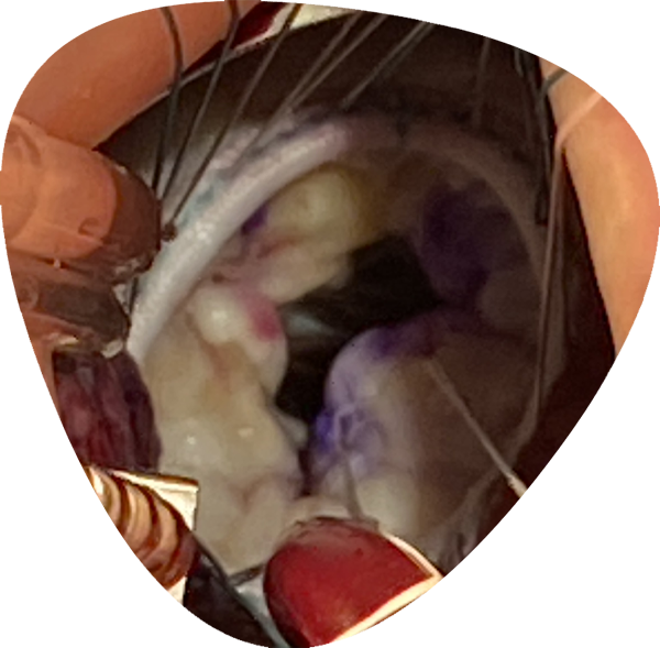 https://www.minicardiacsurgery-univpm-research.com/wp-content/uploads/2021/04/on-site-training-new2.png