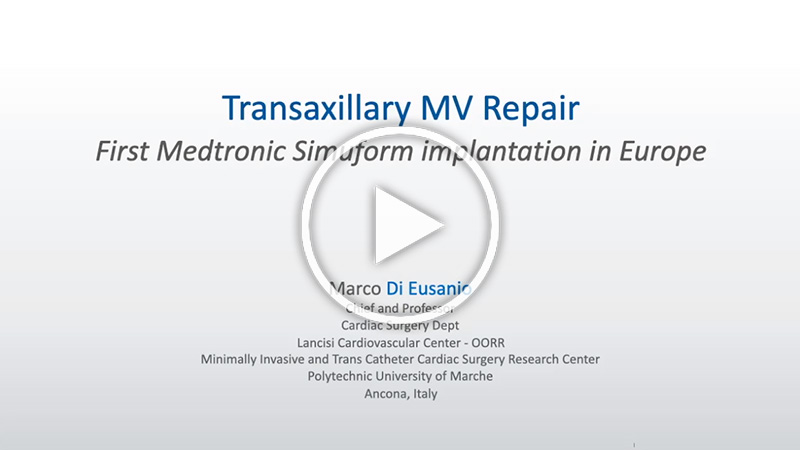 https://www.minicardiacsurgery-univpm-research.com/wp-content/uploads/2021/07/30-Trans-Axillary-Mitral-Valve-Repair.jpg