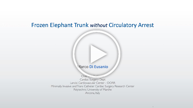 https://www.minicardiacsurgery-univpm-research.com/wp-content/uploads/2022/01/35-Frozen-elephant-trunk.jpg