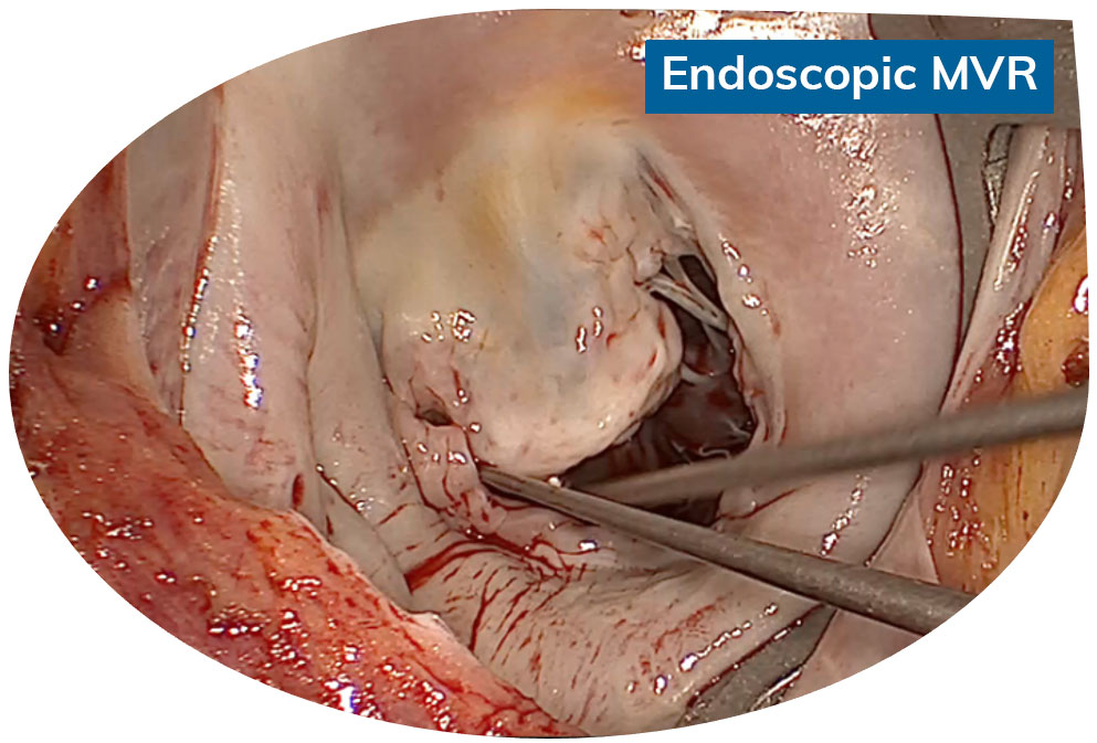 https://www.minicardiacsurgery-univpm-research.com/wp-content/uploads/2024/01/corso-2024-day1-b-1.jpg