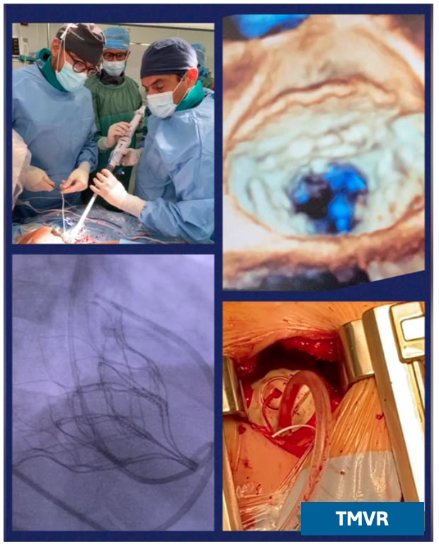 https://www.minicardiacsurgery-univpm-research.com/wp-content/uploads/2024/01/corso-2024-day2-c.jpg